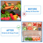 10 Pack Fridge Organizer, Stackable Refrigerator Organizer Bins with Lids, Produce Fruit Storage Containers for Storage Clear for Food, Drinks, Vegetable Storage